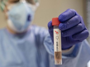 Coronavirus Marche, nelle ultime 24 ore 23 tamponi positivi su 735 campioni analizzati