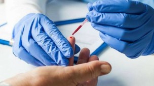 Test sierologici, CNA: su 1.000 prelievi effettuati il 7% dei lavoratori sono risultati positivi