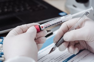 Marche Nord: lo 0,4% del personale è risultato positivo ai test