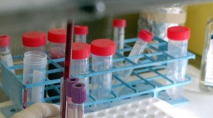 Coronavirus Marche, ieri 5 tamponi positivi su 680 campioni analizzati