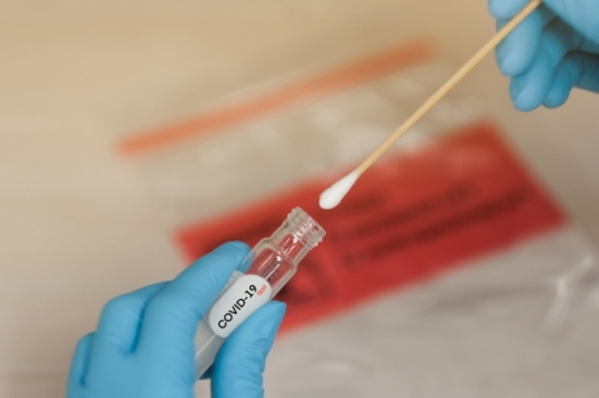 Covid Marche: 508 nuovi positivi in tutta la regione, il 19% dei tamponi effettuati nelle ultime 24 ore