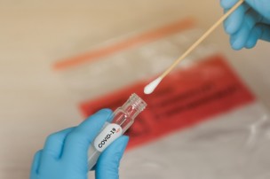 Covid Marche: 564 nuovi positivi nelle ultime 24 ore, 1 ogni 7 tamponi effettuati