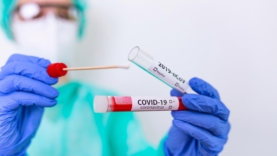 Covid, 53 nuovi positivi nelle Marche su 621 tamponi nel percorso diagnosi