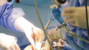 Pesaro, prelievo multiorgano salva vite: un paziente dona fegato, reni e cornee