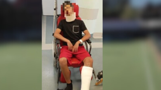 Genitore aggredisce portiere dopo partita giovanile: frattura del malleolo per il 13enne