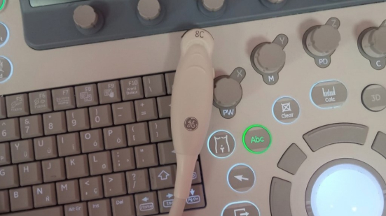 Nuova sonda ecografica al San Salvatore di Pesaro per diagnosi cerebrali precoci nei neonati