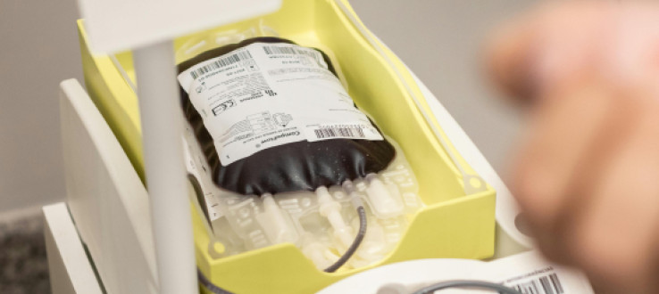 Ancona, 323 sacche di plasma eliminate all’Officina del sangue: polemiche su personale e gestione